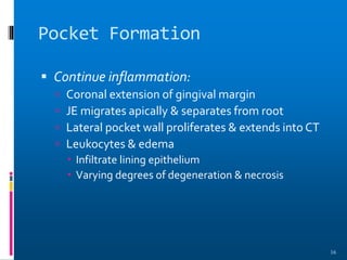 Pocket Formation
 Continue inflammation:
 Coronal extension of gingival margin
 JE migrates apically & separates from root
 Lateral pocket wall proliferates & extends into CT
 Leukocytes & edema
 Infiltrate lining epithelium
 Varying degrees of degeneration & necrosis
16
 