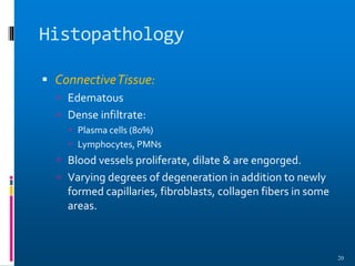 Histopathology
 ConnectiveTissue:
 Edematous
 Dense infiltrate:
 Plasma cells (80%)
 Lymphocytes, PMNs
 Blood vessels proliferate, dilate & are engorged.
 Varying degrees of degeneration in addition to newly
formed capillaries, fibroblasts, collagen fibers in some
areas.
20
 