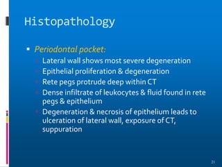 Histopathology
 Periodontal pocket:
 Lateral wall shows most severe degeneration
 Epithelial proliferation & degeneration
 Rete pegs protrude deep within CT
 Dense infiltrate of leukocytes & fluid found in rete
pegs & epithelium
 Degeneration & necrosis of epithelium leads to
ulceration of lateral wall, exposure of CT,
suppuration
21
 