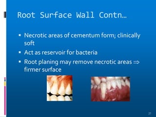Root Surface Wall Contn…
 Necrotic areas of cementum form; clinically
soft
 Act as reservoir for bacteria
 Root planing may remove necrotic areas 
firmer surface
27
 
