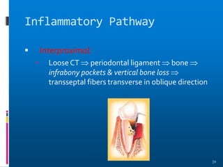 Inflammatory Pathway
 Interproximal:
 Loose CT  periodontal ligament  bone 
infrabony pockets & vertical bone loss 
transseptal fibers transverse in oblique direction
29
 