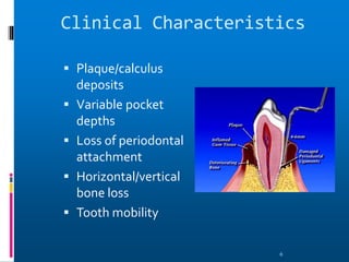 Clinical Characteristics
 Plaque/calculus
deposits
 Variable pocket
depths
 Loss of periodontal
attachment
 Horizontal/vertical
bone loss
 Tooth mobility
6
 