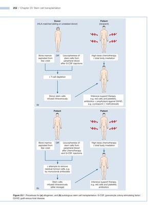 252 / Chapter 23: Stem cell transplantation
Figure 23.1 Procedures for (a) allogeneic, and (b) autologous stem cell transplantation. G-CSF, granulocyte colony-stimulating factor;
GVHD, graft-versus-host disease.
Donor
(a)
(HLA-matched sibling or unrelated donor)
Patient
(recipient)
High-dose chemotherapy
± total body irradiation
± T-cell depletion
Bone marrow
aspirated from
iliac crest
OR Leucopheresis of
stem cells from
peripheral blood
after G-CSF injections
Donor stem cells
infused intravenously
Intensive support therapy,
e.g. red cells and platelets,
antibiotics + prophylaxis against GVHD,
e.g. cyclosporin ± methotrexate
t
n
e
i
t
a
P
t
n
e
i
t
a
P
High-dose chemotherapy
± total body irradiation
± attempts to remove
residual tumour cells, e.g.
by monoclonal antibodies
Bone marrow
aspirated from
iliac crest
OR Leucopheresis of
stem cells from
peripheral blood
after chemotherapy
and G-CSF injections
Intensive support therapy,
e.g. red cells and platelets,
antibiotics
Stem cells
infused intravenously
(after storage)
(b)
 