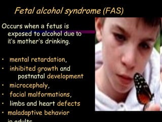 Fetal alcohol syndrome (FAS)
Occurs when a fetus is
exposed to alcohol due to
it’s mother’s drinking.
• mental retardation,
• inhibited growth and
postnatal development
• microcephaly,
• facial malformations,
• limbs and heart defects
• maladaptive behavior
 