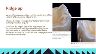 Sufficient Ridges PARTIAL BONDED RESTORATIONS AND IT’S ADHESION.pptx