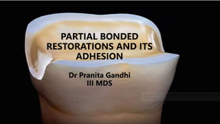 PARTIAL BONDED
RESTORATIONS AND ITS
ADHESION
Dr Pranita Gandhi
III MDS
 