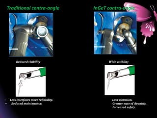 Traditional contra-angle InGeT contra-angle
Reduced visibility Wide visibility
• Less interfaces more reliability. Less vibration.
• Reduced maintenance. Greater ease of cleaning.
Increased safety.
 
