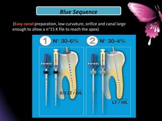 Blue Sequence
(Easy canal preparation, low curvature, orifice and canal large
enough to allow a n°15 K file to reach the apex)
 