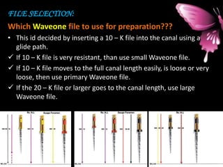 FILE SELECTION:
Which Waveone file to use for preparation???
• This id decided by inserting a 10 – K file into the canal using a
glide path.
 If 10 – K file is very resistant, than use small Waveone file.
 If 10 – K file moves to the full canal length easily, is loose or very
loose, then use primary Waveone file.
 If the 20 – K file or larger goes to the canal length, use large
Waveone file.
 