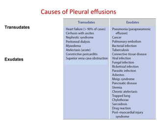Causes of Pleural effusions
 