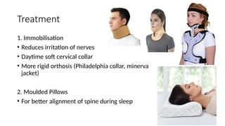 Treatment
1. Immobilisation
• Reduces irritation of nerves
• Daytime soft cervical collar
• More rigid orthosis (Philadelphia collar, minerva
jacket)
2. Moulded Pillows
• For better alignment of spine during sleep
 