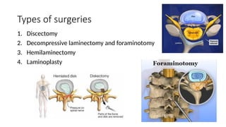 Types of surgeries
1. Discectomy
2. Decompressive laminectomy and foraminotomy
3. Hemilaminectomy
4. Laminoplasty
 