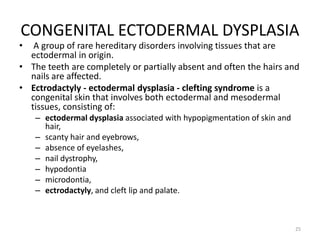 CONGENITAL ECTODERMAL DYSPLASIA
• A group of rare hereditary disorders involving tissues that are
ectodermal in origin.
• The teeth are completely or partially absent and often the hairs and
nails are affected.
• Ectrodactyly - ectodermal dysplasia - clefting syndrome is a
congenital skin that involves both ectodermal and mesodermal
tissues, consisting of:
– ectodermal dysplasia associated with hypopigmentation of skin and
hair,
– scanty hair and eyebrows,
– absence of eyelashes,
– nail dystrophy,
– hypodontia
– microdontia,
– ectrodactyly, and cleft lip and palate.
25
 
