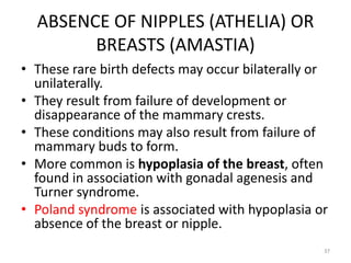 ABSENCE OF NIPPLES (ATHELIA) OR
BREASTS (AMASTIA)
• These rare birth defects may occur bilaterally or
unilaterally.
• They result from failure of development or
disappearance of the mammary crests.
• These conditions may also result from failure of
mammary buds to form.
• More common is hypoplasia of the breast, often
found in association with gonadal agenesis and
Turner syndrome.
• Poland syndrome is associated with hypoplasia or
absence of the breast or nipple.
37
 