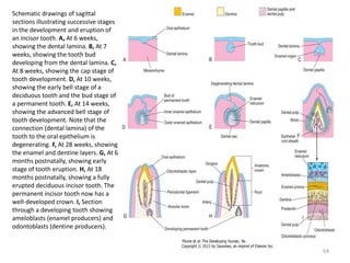 Schematic drawings of sagittal
sections illustrating successive stages
in the development and eruption of
an incisor tooth. A, At 6 weeks,
showing the dental lamina. B, At 7
weeks, showing the tooth bud
developing from the dental lamina. C,
At 8 weeks, showing the cap stage of
tooth development. D, At 10 weeks,
showing the early bell stage of a
deciduous tooth and the bud stage of
a permanent tooth. E, At 14 weeks,
showing the advanced bell stage of
tooth development. Note that the
connection (dental lamina) of the
tooth to the oral epithelium is
degenerating. F, At 28 weeks, showing
the enamel and dentine layers. G, At 6
months postnatally, showing early
stage of tooth eruption. H, At 18
months postnatally, showing a fully
erupted deciduous incisor tooth. The
permanent incisor tooth now has a
well-developed crown. I, Section
through a developing tooth showing
ameloblasts (enamel producers) and
odontoblasts (dentine producers).
64
 