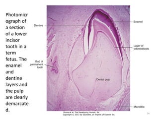 Photomicr
ograph of
a section
of a lower
incisor
tooth in a
term
fetus. The
enamel
and
dentine
layers and
the pulp
are clearly
demarcate
d.
74
 