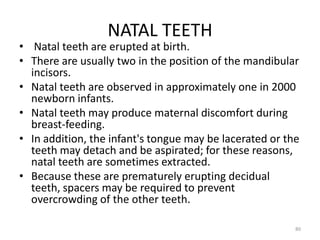 NATAL TEETH
• Natal teeth are erupted at birth.
• There are usually two in the position of the mandibular
incisors.
• Natal teeth are observed in approximately one in 2000
newborn infants.
• Natal teeth may produce maternal discomfort during
breast-feeding.
• In addition, the infant's tongue may be lacerated or the
teeth may detach and be aspirated; for these reasons,
natal teeth are sometimes extracted.
• Because these are prematurely erupting decidual
teeth, spacers may be required to prevent
overcrowding of the other teeth.
80
 