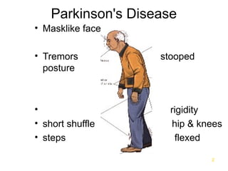 12.13 - Antiparkinson Agents [may2009-feb2013].ppt