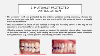 Tooth Disocclude 12. implant occlusion.pptx prosthodontics | PPTX