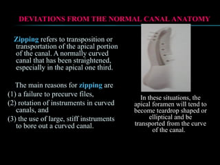 Zipping refers to transposition or
transportation of the apical portion
of the canal. A normally curved
canal that has been straightened,
especially in the apical one third.
The main reasons for zipping are
(1) a failure to precurve files,
(2) rotation of instruments in curved
canals, and
(3) the use of large, stiff instruments
to bore out a curved canal.
DEVIATIONS FROM THE NORMAL CANAL ANATOMY
DEVIATIONS FROM THE NORMAL CANAL ANATOMY
In these situations, the
In these situations, the
apical foramen will tend to
apical foramen will tend to
become teardrop shaped or
become teardrop shaped or
elliptical and be
elliptical and be
transported from the curve
transported from the curve
of the canal.
of the canal.
 