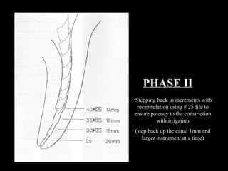 PHASE II
•Stepping back in increments with
recapitulation using # 25 file to
ensure patency to the constriction
with irrigation
(step back up the canal 1mm and
larger instrument at a time)
 