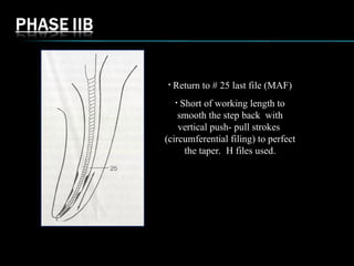 • Return to # 25 last file (MAF)
• Short of working length to
smooth the step back with
vertical push- pull strokes
(circumferential filing) to perfect
the taper. H files used.
 