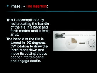  Phase I – File Insertion:
This is accomplished by
reciprocating the handle
of the file in a back and
forth motion until it feels
snug.
The handle of the file is
turned in 90 degrees.
CW rotation to draw the
instrument down and
move its cutting blades
deeper into the canal
and engage dentin.
 