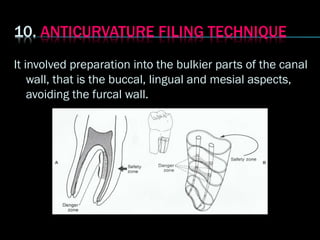 It involved preparation into the bulkier parts of the canal
wall, that is the buccal, lingual and mesial aspects,
avoiding the furcal wall.
 