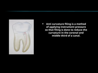  Anti curvature filing is a method
of applying instrument pressure
so that filing is done to reduce the
curvature in the coronal and
middle third of a canal.
 