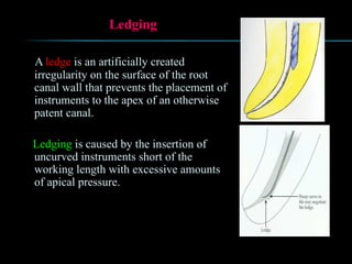 Ledging
A ledge is an artificially created
irregularity on the surface of the root
canal wall that prevents the placement of
instruments to the apex of an otherwise
patent canal.
Ledging is caused by the insertion of
uncurved instruments short of the
working length with excessive amounts
of apical pressure.
 
