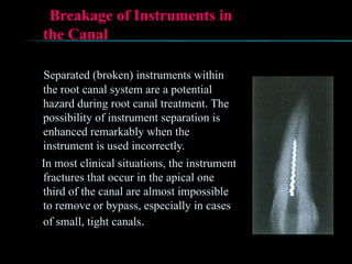 Breakage of Instruments in
the Canal
Separated (broken) instruments within
the root canal system are a potential
hazard during root canal treatment. The
possibility of instrument separation is
enhanced remarkably when the
instrument is used incorrectly.
In most clinical situations, the instrument
fractures that occur in the apical one
third of the canal are almost impossible
to remove or bypass, especially in cases
of small, tight canals.
 