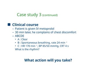 Case study 3 (continued)
Clinical course
– Patient is given IV metoprolol
– 30 min later, he complains of chest discomfort
– ABCDE
• A : Clear
• B : Spontaneous breathing, rate 24 min -1
• C : HR 170 min -1
, BP 85/50 mmHg, CRT 4 s
What is the rhythm?
What action will you take?
 