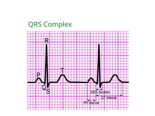QRS Complex
 