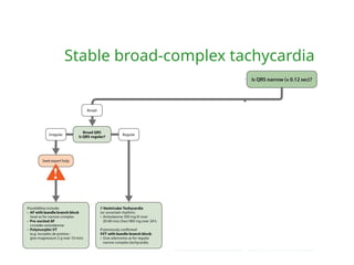 Stable broad-complex tachycardia
 