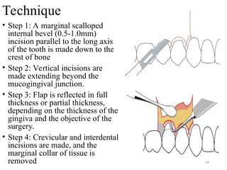 Marginal Tooth Incision PERIODONTAL FLAP - Classification, Design, Healing | PPT