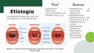Comprehensive Overview of Pharyngitis, Tonsillitis, and Adenoiditis ...
