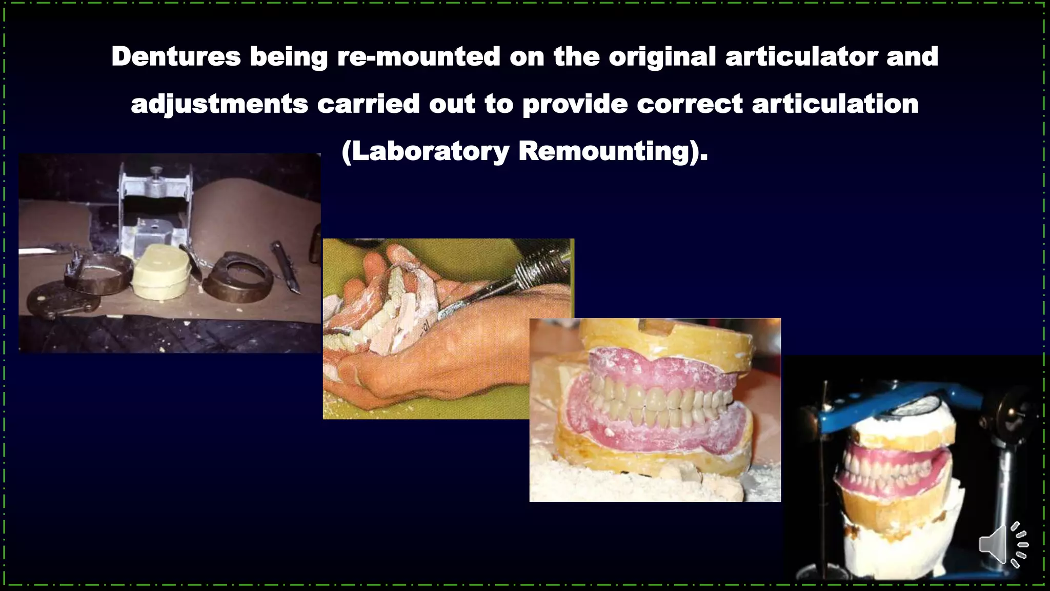 Dentures being re-mounted on the original articulator and
adjustments carried out to provide correct articulation
(Laboratory Remounting).
 