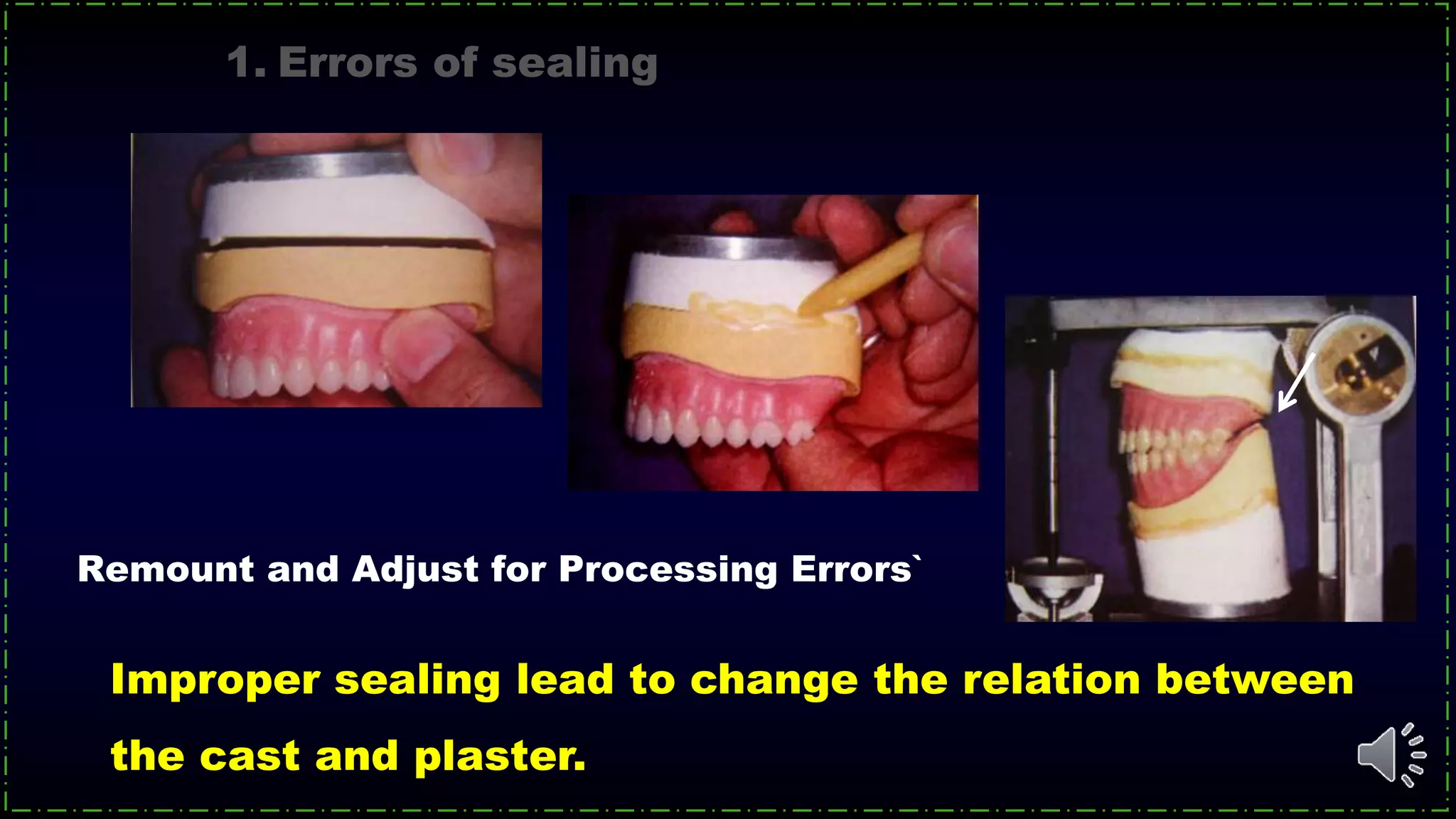Remount and Adjust for Processing Errors`
1. Errors of sealing
Improper sealing lead to change the relation between
the cast and plaster.
 