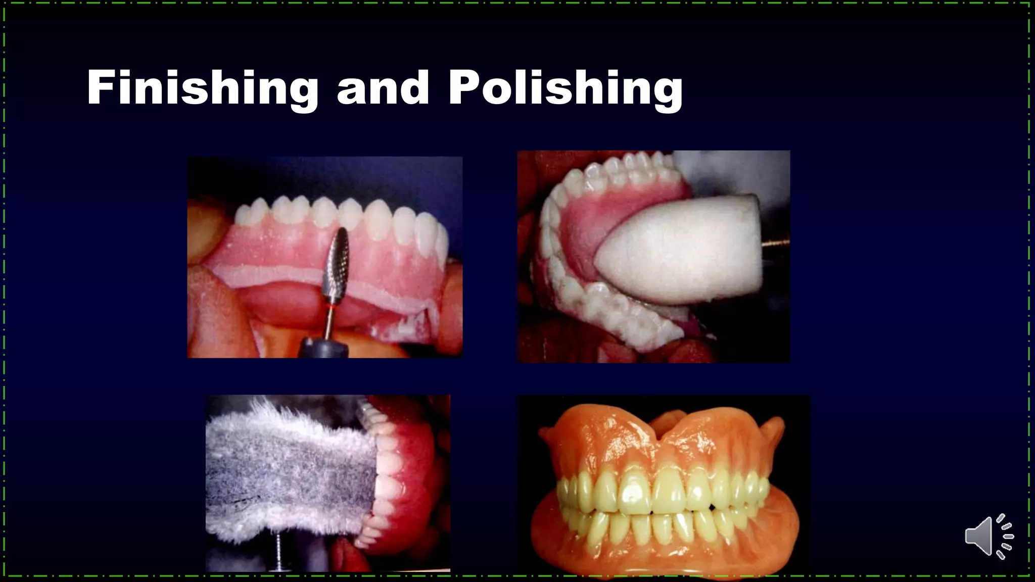 Finishing and Polishing
 