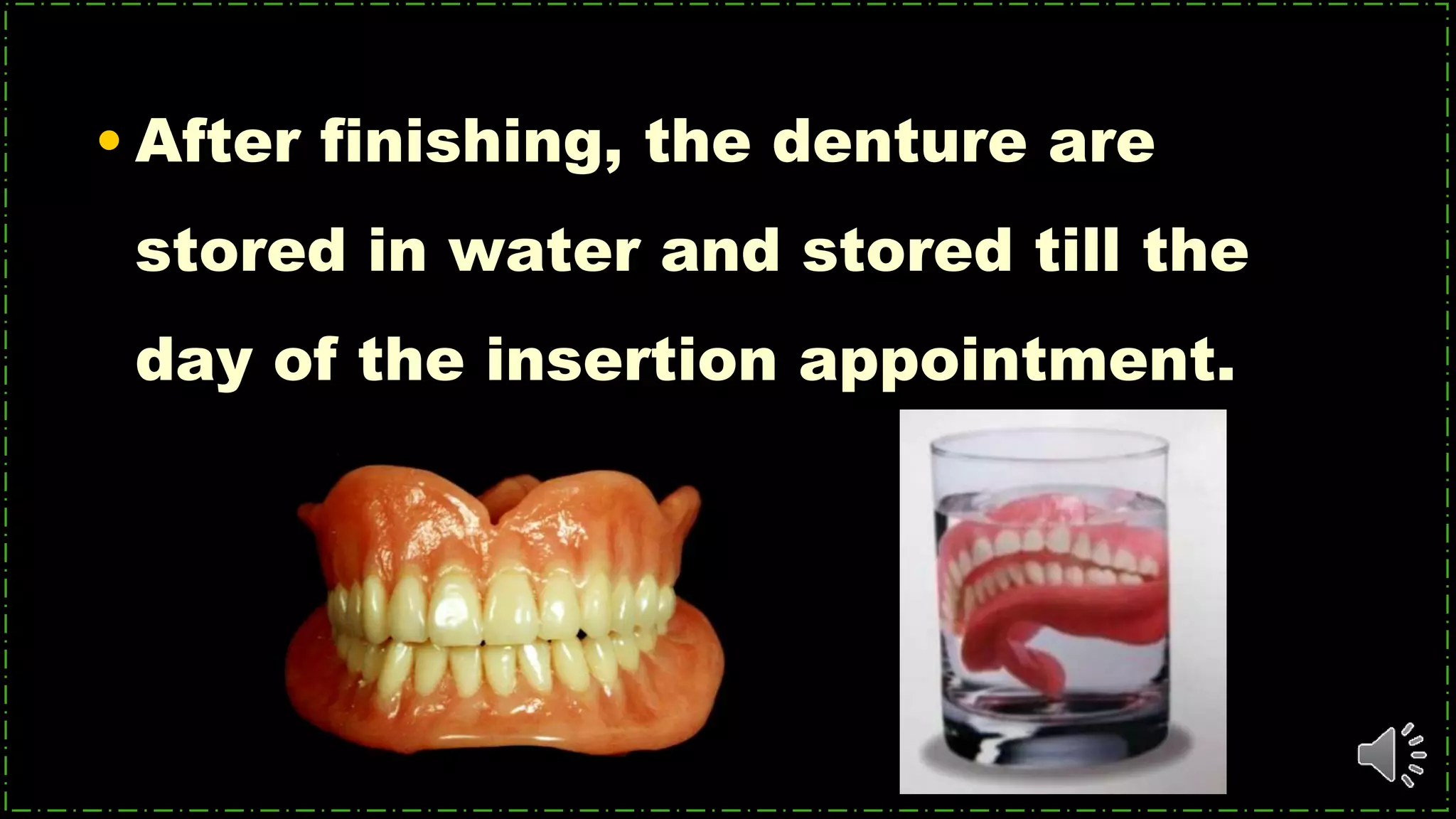 • After finishing, the denture are
stored in water and stored till the
day of the insertion appointment.
 