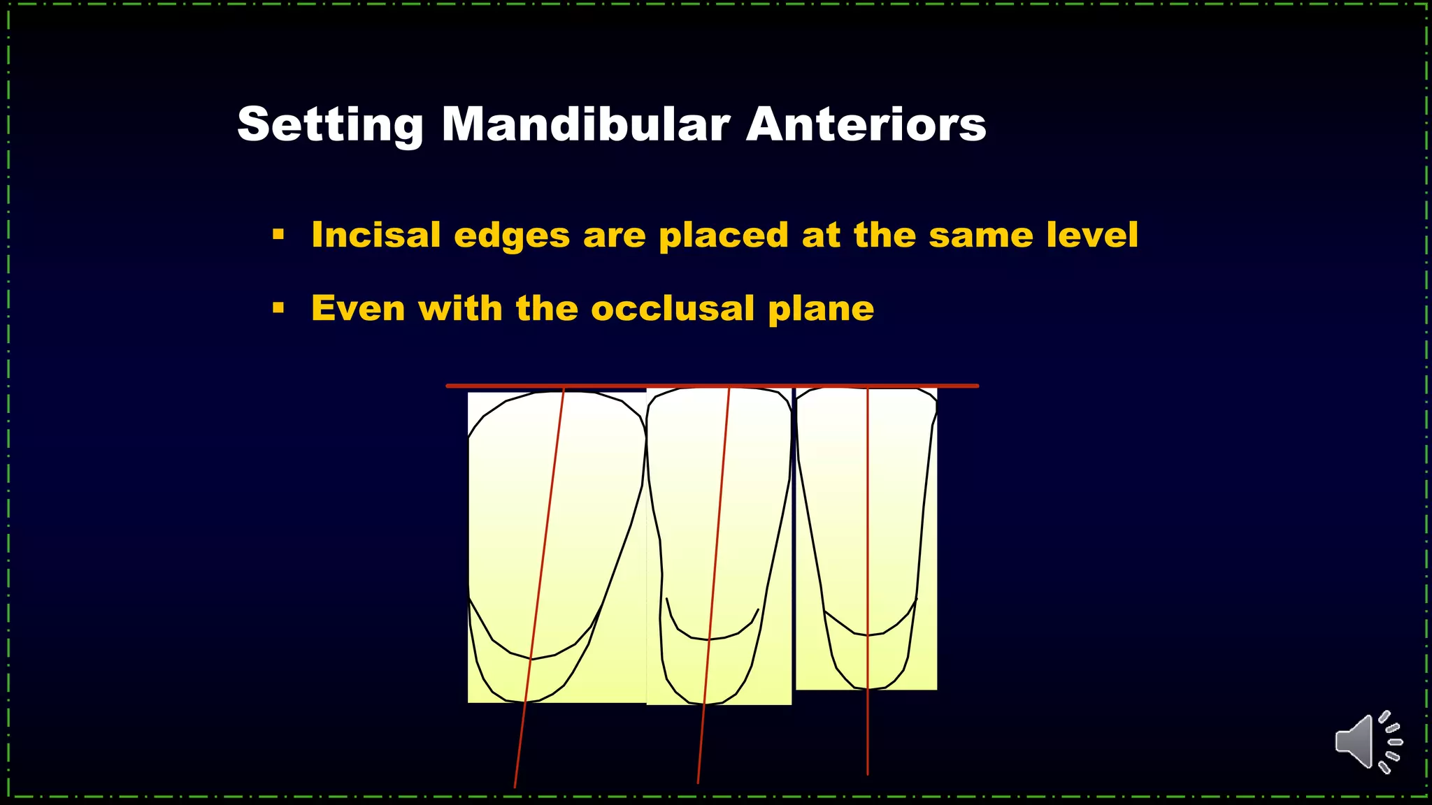 Setting Mandibular Anteriors
 Incisal edges are placed at the same level
 Even with the occlusal plane
 