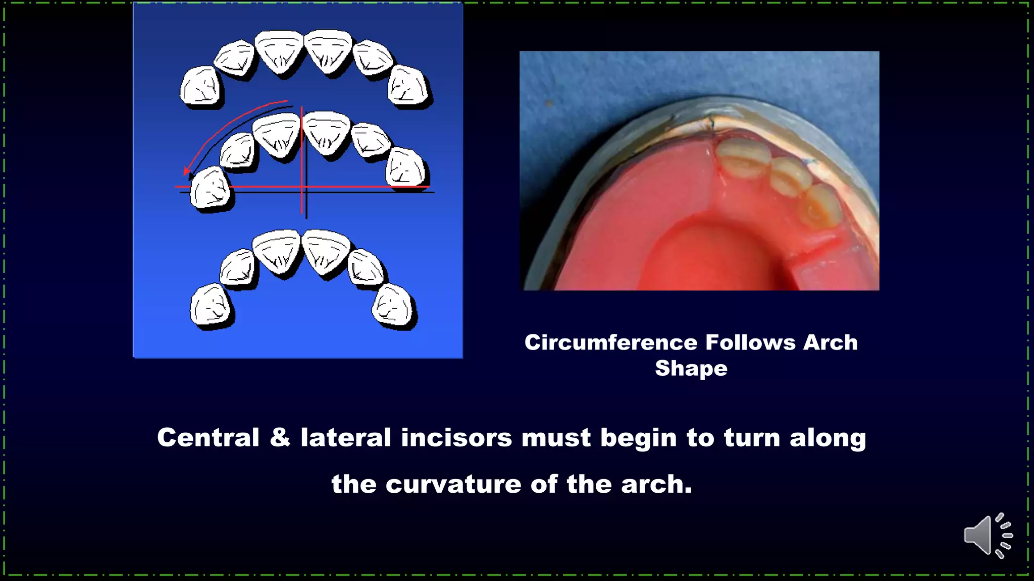 Central & lateral incisors must begin to turn along
the curvature of the arch.
Circumference Follows Arch
Shape
 