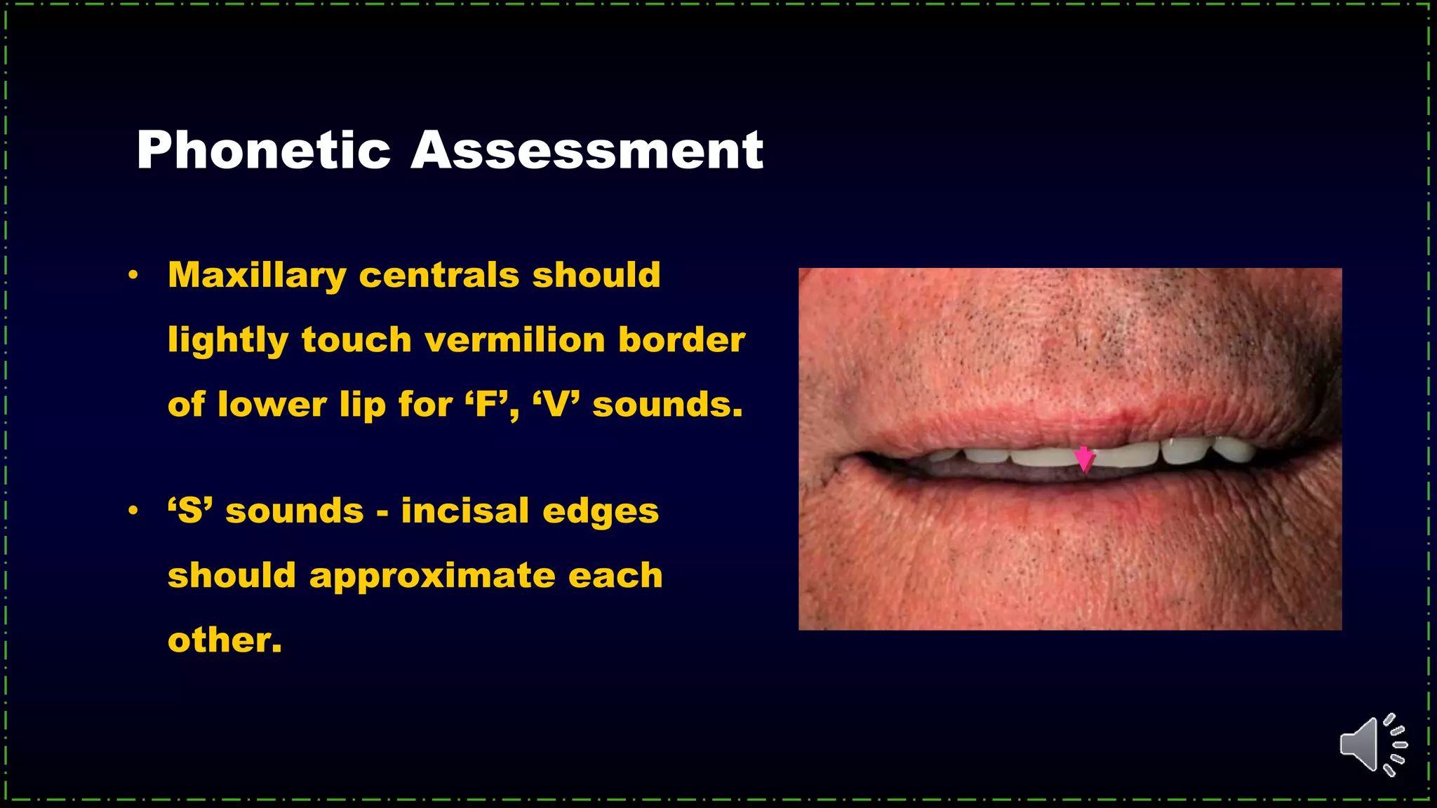 Phonetic Assessment
• Maxillary centrals should
lightly touch vermilion border
of lower lip for ‘F’, ‘V’ sounds.
• ‘S’ sounds - incisal edges
should approximate each
other.
 