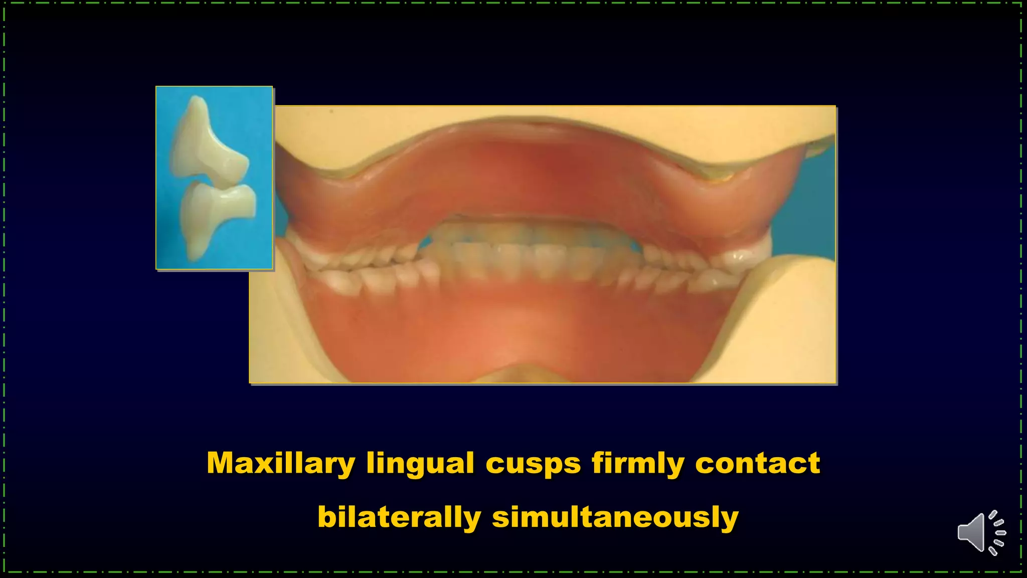 Maxillary lingual cusps firmly contact
bilaterally simultaneously
 