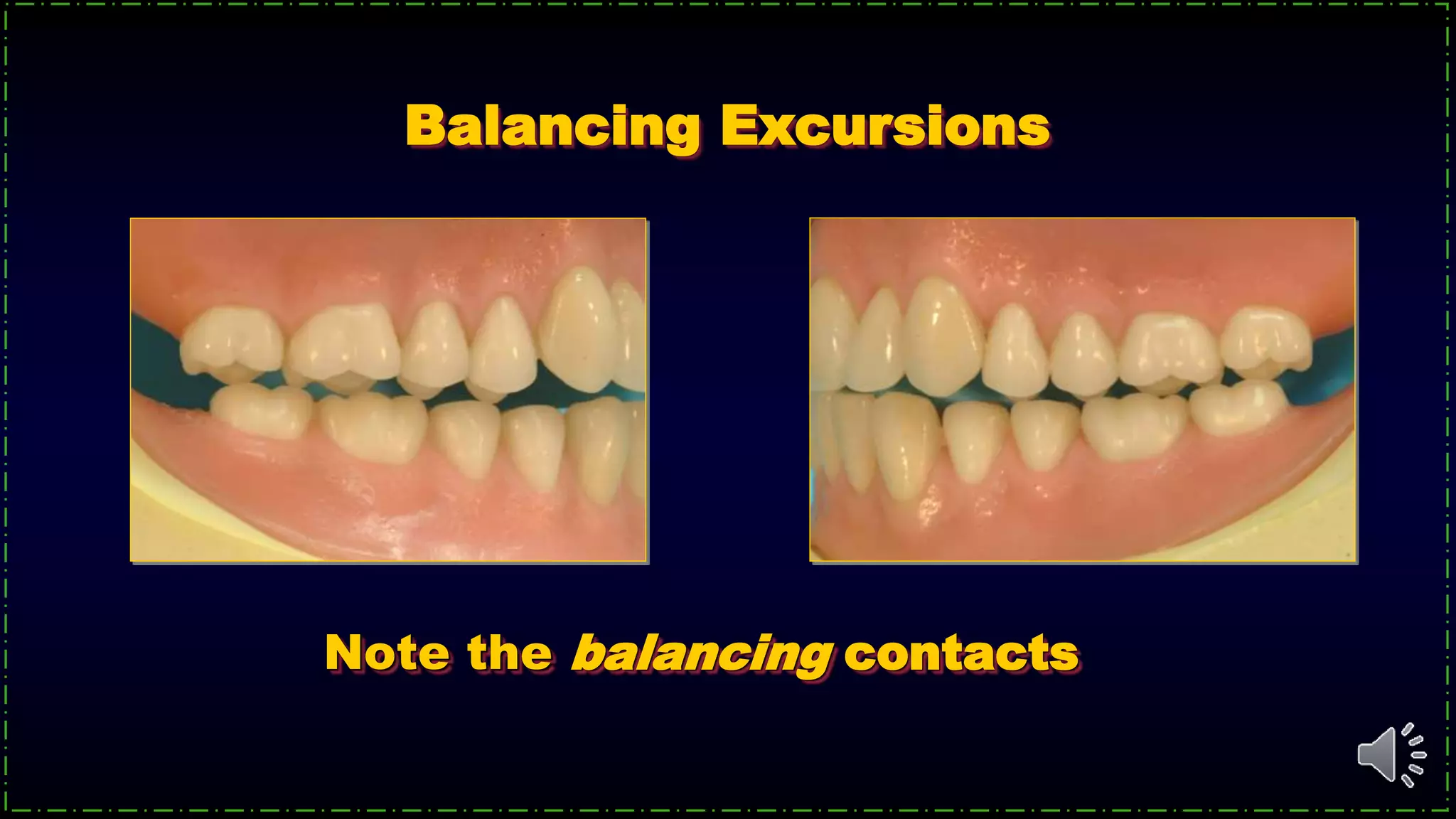 Note the balancing contacts
Balancing Excursions
 