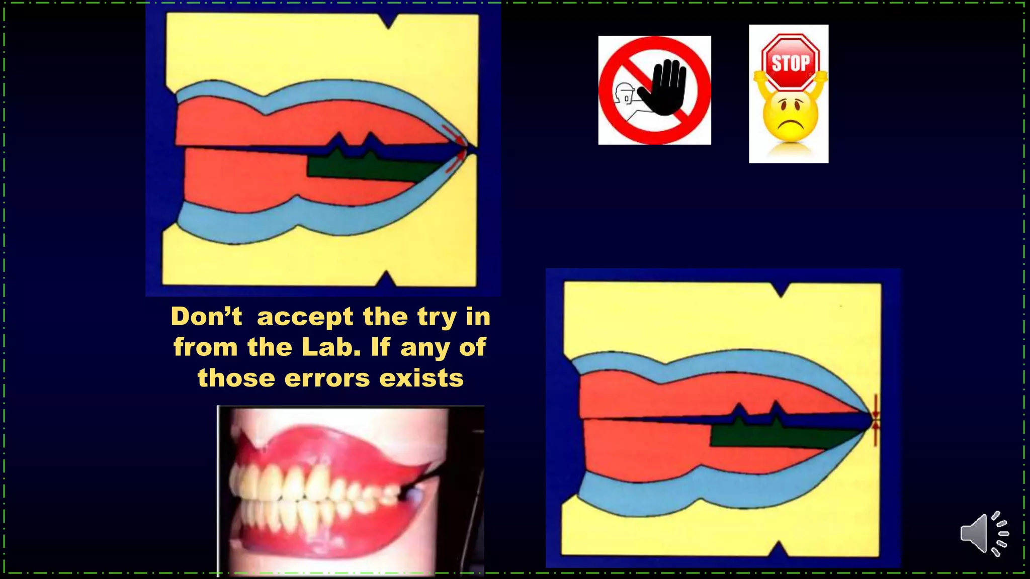 Don’t accept the try in
from the Lab. If any of
those errors exists
 