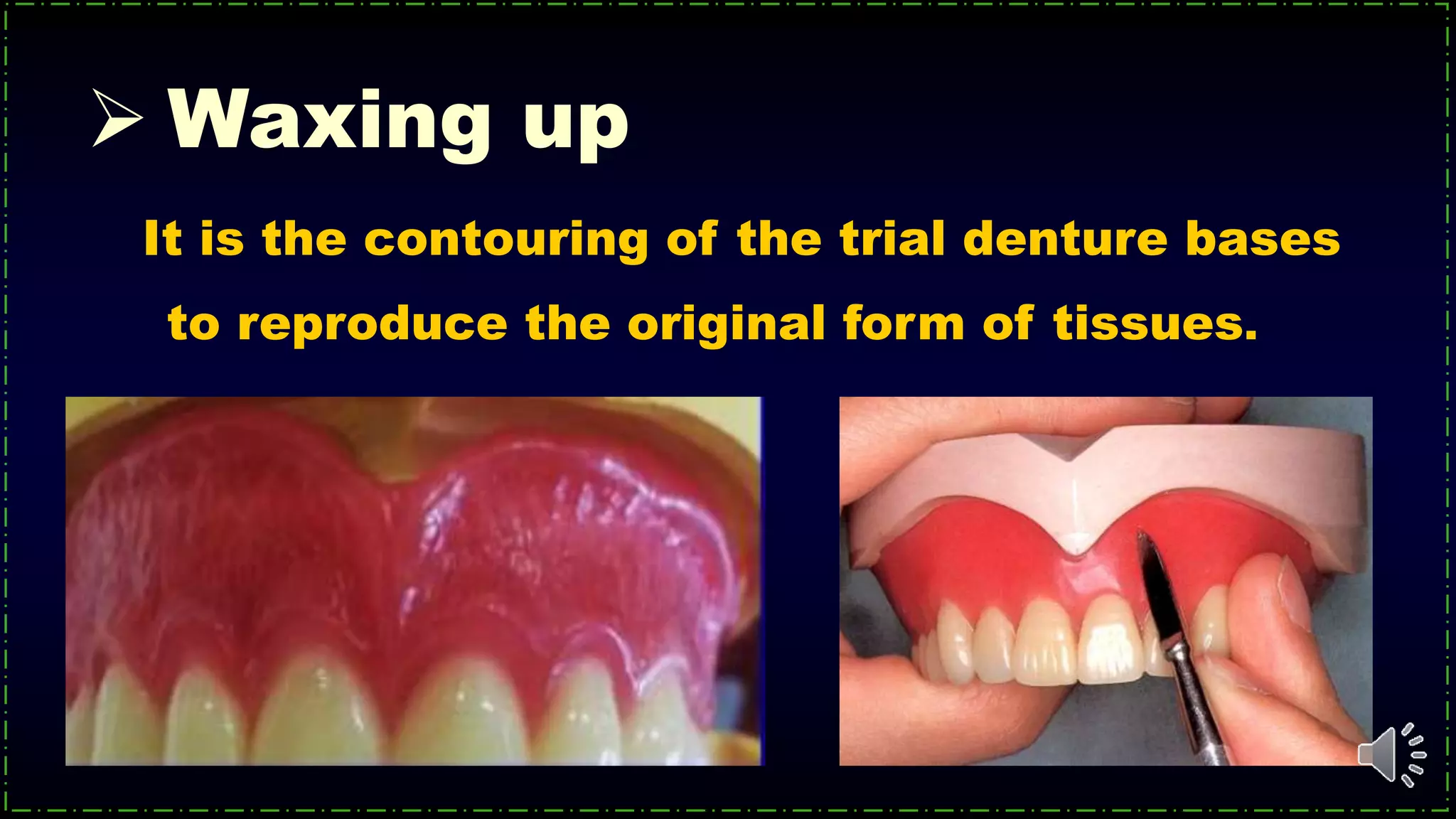 It is the contouring of the trial denture bases
to reproduce the original form of tissues.
 Waxing up
 