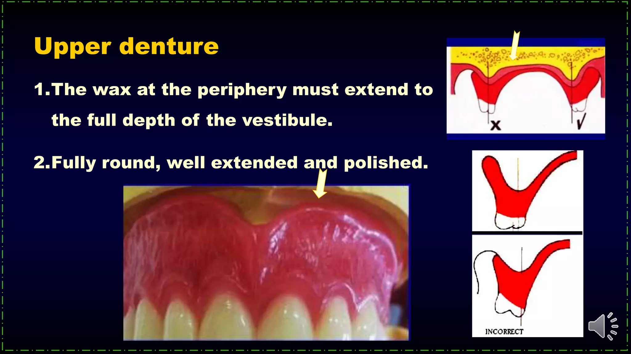 Upper denture
1.The wax at the periphery must extend to
the full depth of the vestibule.
2.Fully round, well extended and polished.
 