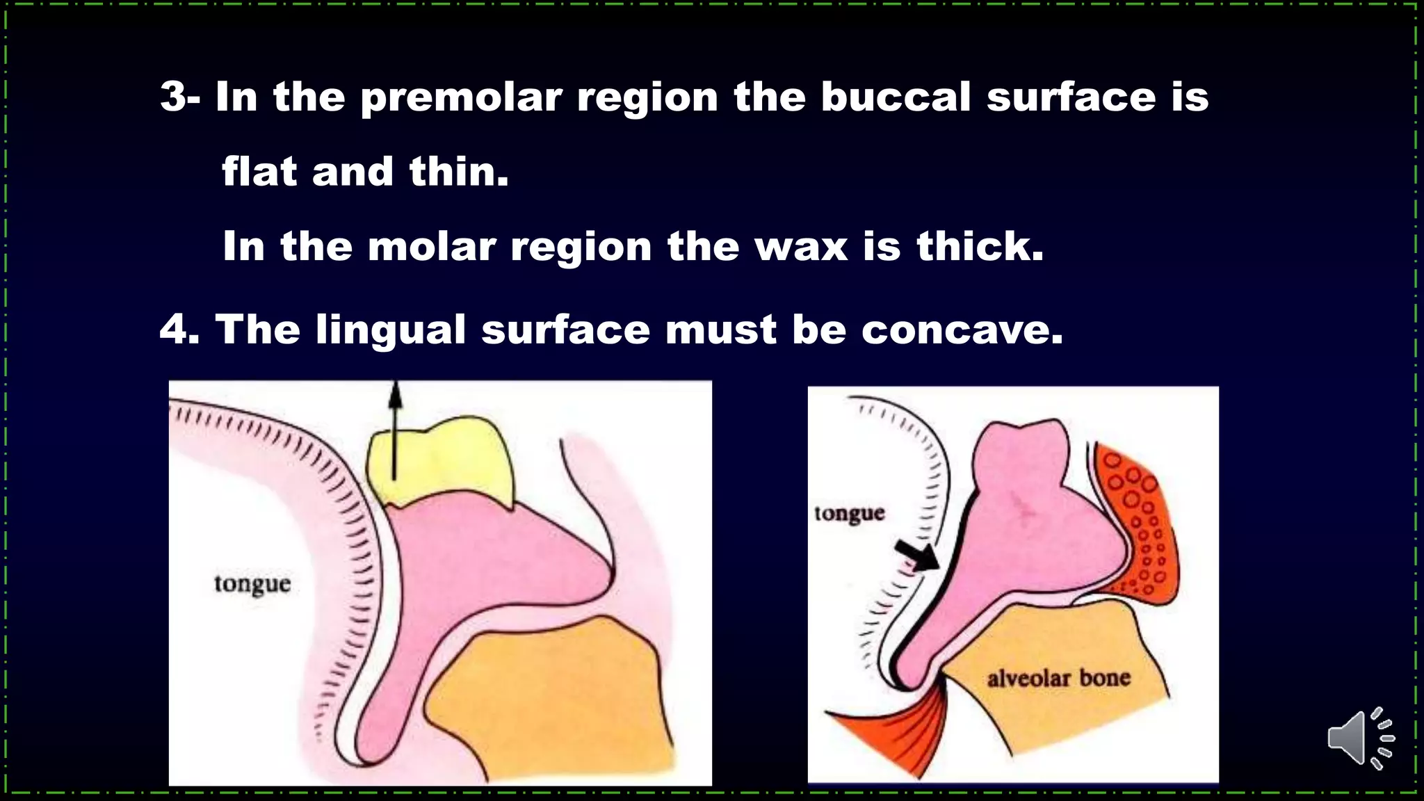 3- In the premolar region the buccal surface is
flat and thin.
In the molar region the wax is thick.
4. The lingual surface must be concave.
 