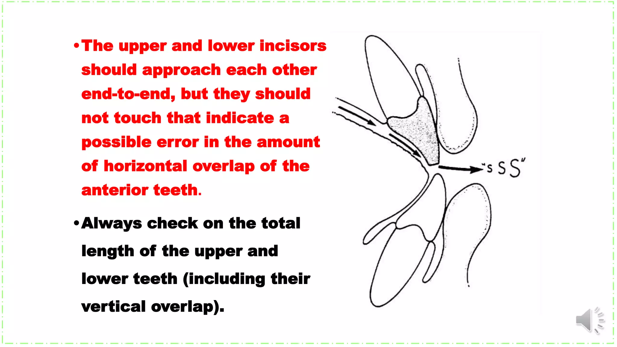 •Always check on the total
length of the upper and
lower teeth (including their
vertical overlap).
•The upper and lower incisors
should approach each other
end-to-end, but they should
not touch that indicate a
possible error in the amount
of horizontal overlap of the
anterior teeth.
 